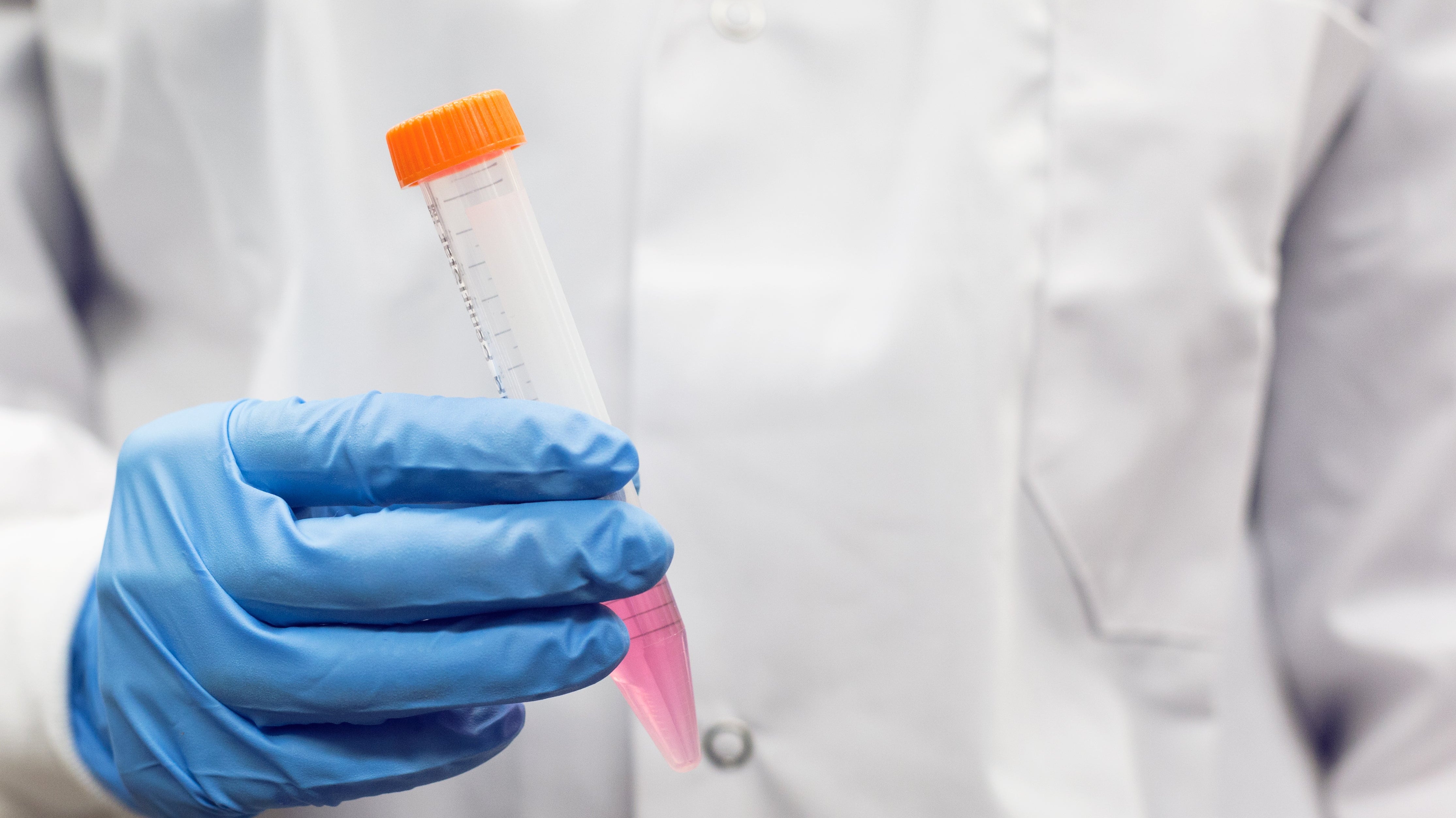 Best Practices in Sterile Liquid Filling for Diagnostic Manufacturing