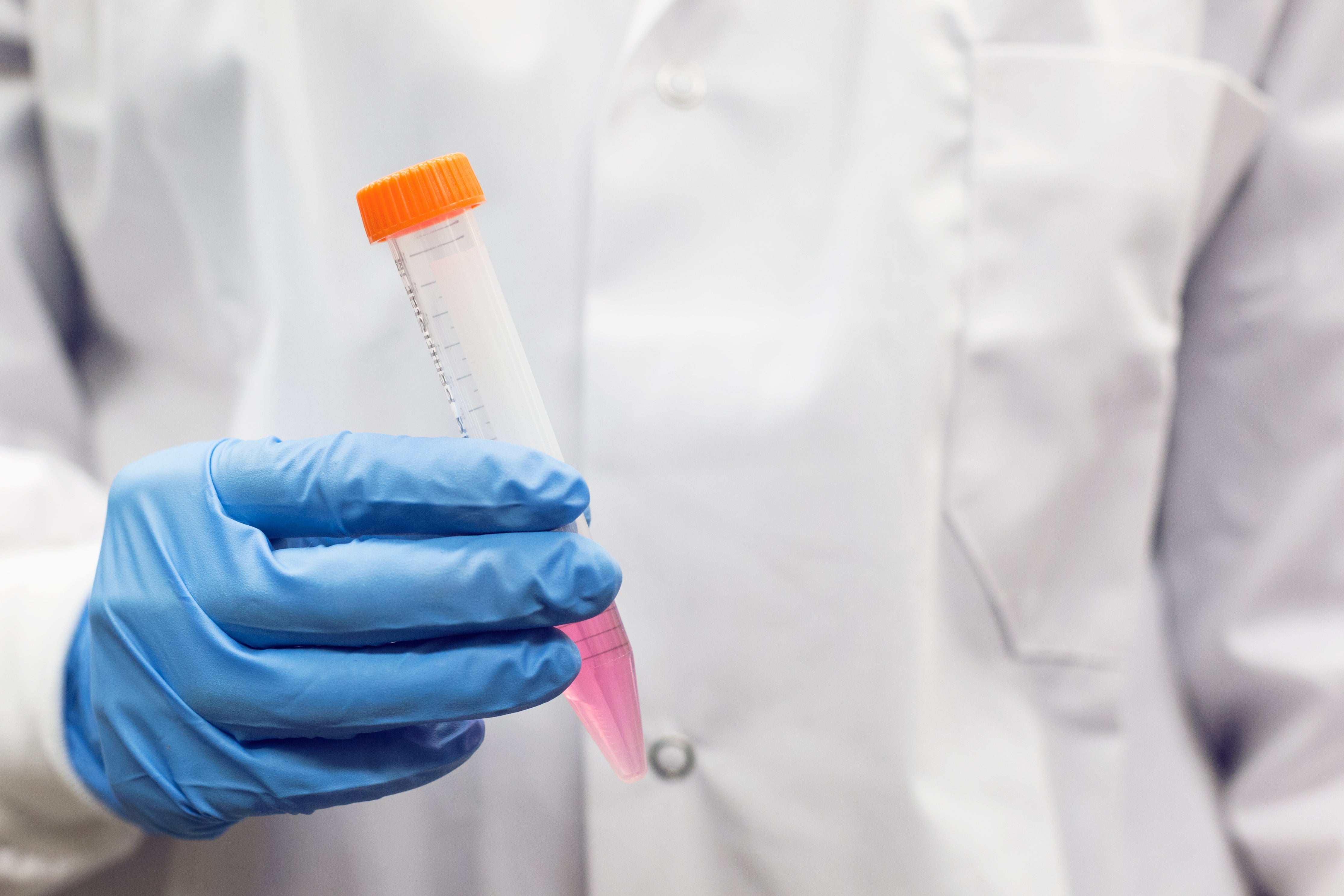 Best Practices in Sterile Liquid Filling for Diagnostic Manufacturing